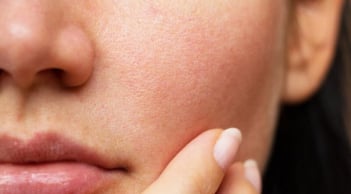 Ngồi điều hòa nhiều khiến da khô ráp? Thử ngay phương pháp dưỡng da “nhiều lớp” để giữ da căng mịn