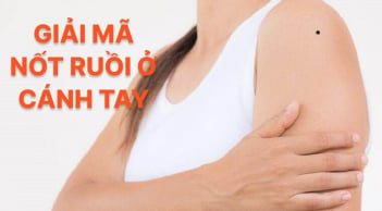 4 nốt ruồi trên cánh tay mang tới may mắn cho bạn: Đừng dại xóa đi