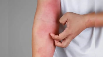 4 dấu hiệu cảnh báo bạn đang bị suy thận: Kiểm tra ngay xem bạn có không?