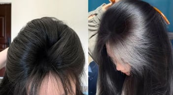 5 mẹo gội đầu giúp tóc lâu bết, ít rụng, cả tuần vẫn bồng bềnh