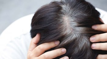 Tóc bạc sớm ở 3 vị trí này có thể là dấu hiệu gan, thận suy yếu