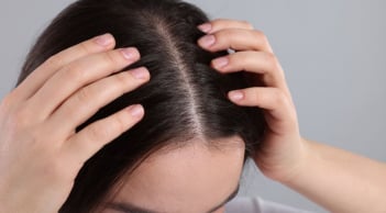 Nguyên nhân gội đầu xong vẫn nhiều gàu và ngứa