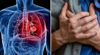 5 dấu hiệu nguy hiểm cảnh báo ung thư phổi, không phải ho như nhiều người nghĩ