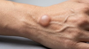 Cảnh báo: 4 thay đổi bất thường ở cánh tay có thể là 'tín hiệu cầu cứu' của cơ thể trước bệnh ung thư