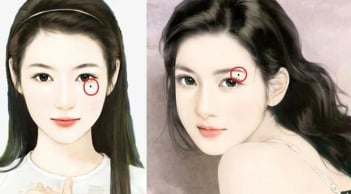 3 vị trí  nốt ruồi trên mặt mang tới may mắn