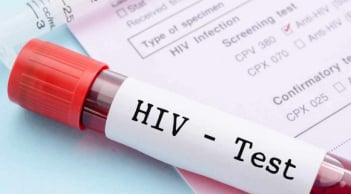 Dấu hiệu HIV trên cơ thể: Những biểu hiện âm thầm dễ bị bỏ qua