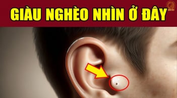 3 nốt ruồi hao tài lận đận tình duyên