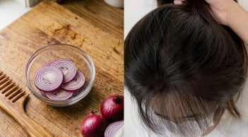 Cách dùng hành tây ủ tóc, làm tóc con mọc tua tủa, không có mùi khó chịu