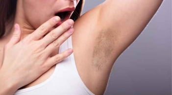 Nguyên nhân khiến vùng da dưới cánh tay thâm sạm và những cách chăm sóc đơn giản tại nhà