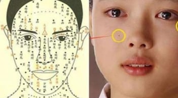 3 nốt ruồi hao tài khánh kiệt nên hóa giải