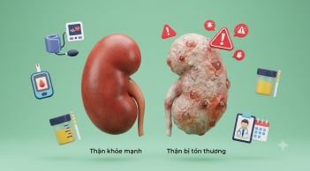 Thận có thể tổn thương nặng mà cơ thể gần như không báo động, bác sĩ chỉ ra lý do