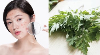 Lá ngải cứu có giúp làm mờ nám?