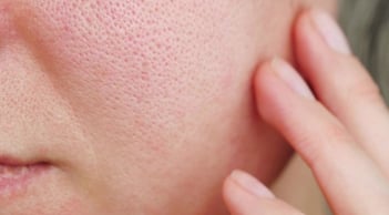Lỗ chân lông trông nhỏ hơn nhờ quy trình chăm sóc da chỉ với 4 bước cơ bản