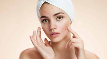 Nặn mụn xong đừng vội làm điều này nếu không muốn da thâm lâu và dễ để lại sẹo