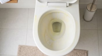 Mẹo tẩy sạch vết ố vàng cứng đầu trên bồn cầu