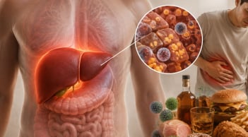 Những dấu hiệu này thì đừng chủ quan: Gan đang 'kêu cứu' nhưng nhiều người bỏ qua