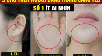 3 chỗ trên người càng trắng càng yếu, số 1 ít ai nhìn