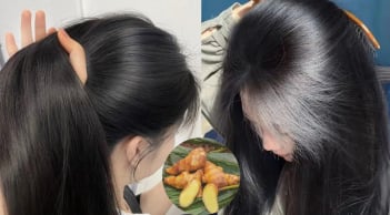 Cách gội đầu bằng gừng giúp tóc mọc nhanh, càng dùng tóc càng dày