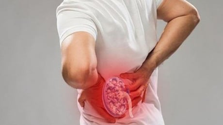 Thận yếu là gì? Cách nhận biết thận khỏe hay yếu không nên bỏ qua