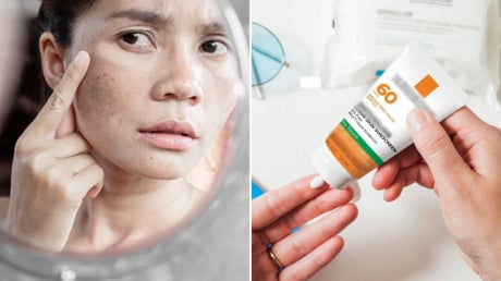 Sai lầm khi thoa kem chống nắng làm da sạm nám nhiều hơn