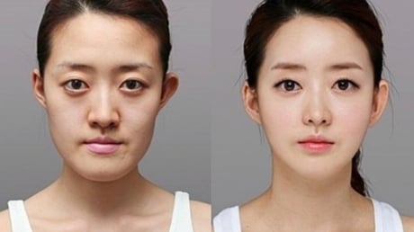 Theo nhân tướng học, phẫu thuật thẩm mỹ có ảnh hưởng đến vận mệnh?