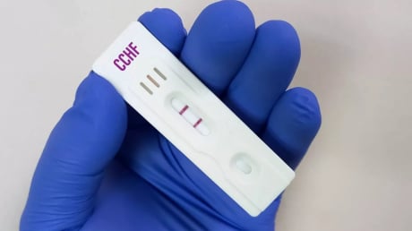 WHO cảnh báo: Phát hiện biến thể COVID-19 NB.1.8.1 lây lan nhanh, khả năng 'né' miễn dịch sau tiêm vaccine