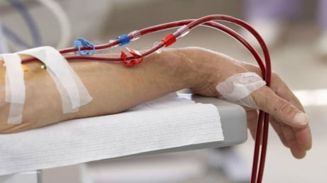 7 dấu hiệu suy thận giai đoạn cuối: Chủ quan tính mạng tính bằng tháng