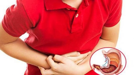 9 dấu hiệu cảnh báo bệnh K dạ dày sớm: Có 1 cũng nên đi khám gấp