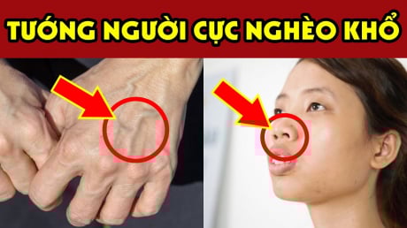 Người có 3 nét tướng này càng sống càng Bạc Phúc: Trẻ thì ốm đau hao tài, già thì cô độc nghèo khổ