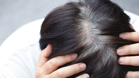 Tóc bạc sớm ở 3 vị trí này có thể là dấu hiệu gan, thận suy yếu