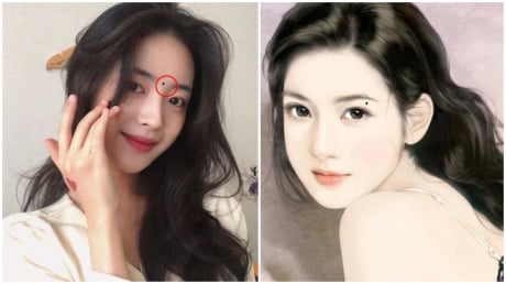 3 nốt ruồi trên mặt mang tới may mắn: Đừng dại xóa đi