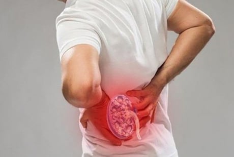 Thận yếu là gì? Cách nhận biết thận khỏe hay yếu không nên bỏ qua