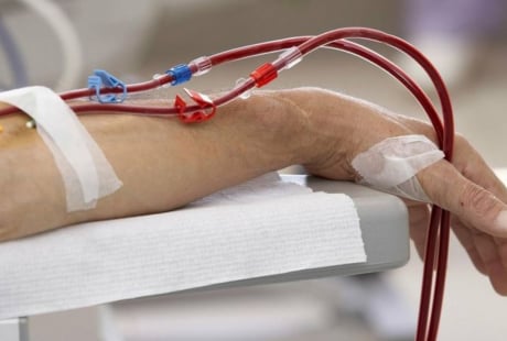 7 dấu hiệu suy thận giai đoạn cuối: Chủ quan tính mạng tính bằng tháng