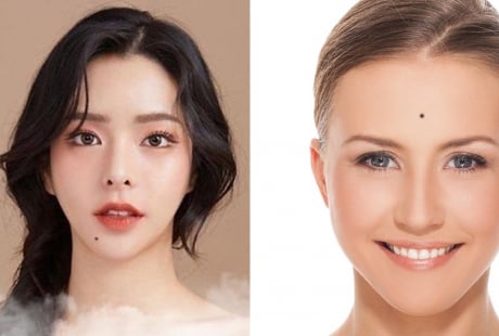 Người sở hữu 1 trong 3 nốt ruồi này đều mang phú quý, về giàu tiền đầy két, giàu 3 đời
