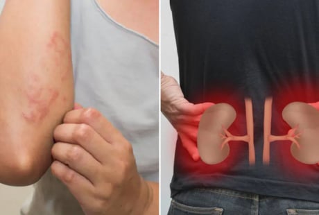 Cơ thể có 7 dấu hiệu này, cảnh báo bệnh thận, suy thận đang đến gần