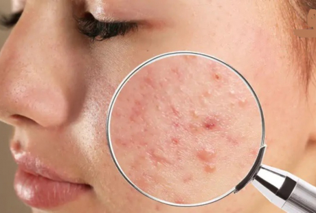 Bạn có đang tiêu thụ đường quá nhiều? Đây là 4 dấu hiệu cho thấy