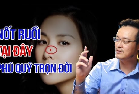 3 nốt ruồi may mắn giàu sang trọn đời