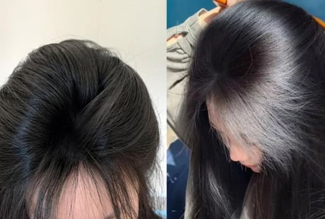 5 mẹo gội đầu giúp tóc lâu bết, ít rụng, cả tuần vẫn bồng bềnh