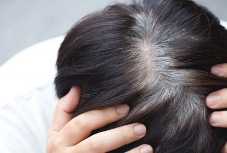 Tóc bạc sớm ở 3 vị trí này có thể là dấu hiệu gan, thận suy yếu