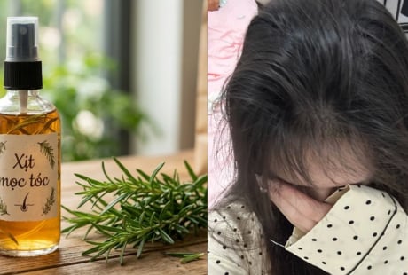 2 cách làm nước xịt mọc tóc bằng nguyên liệu tự nhiên