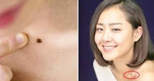 5 nốt ruồi giàu sang, ai sở hữu 1/5 cũng đủ phát tài may mắn hơn người